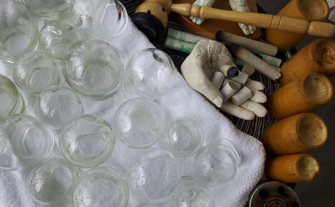 Ventouses / Cupping  (30 minutes)
